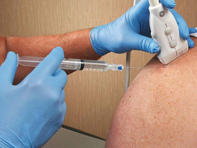 infiltratii-ghidate-ecografic